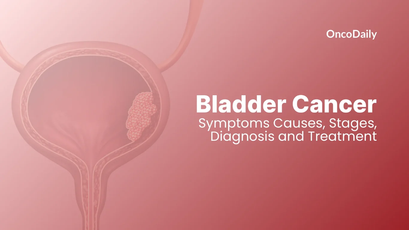 Bladder Cancer Remission Rate