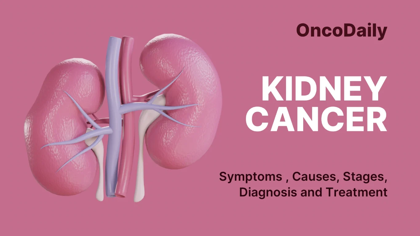 Kidney Cancer Remission Rate