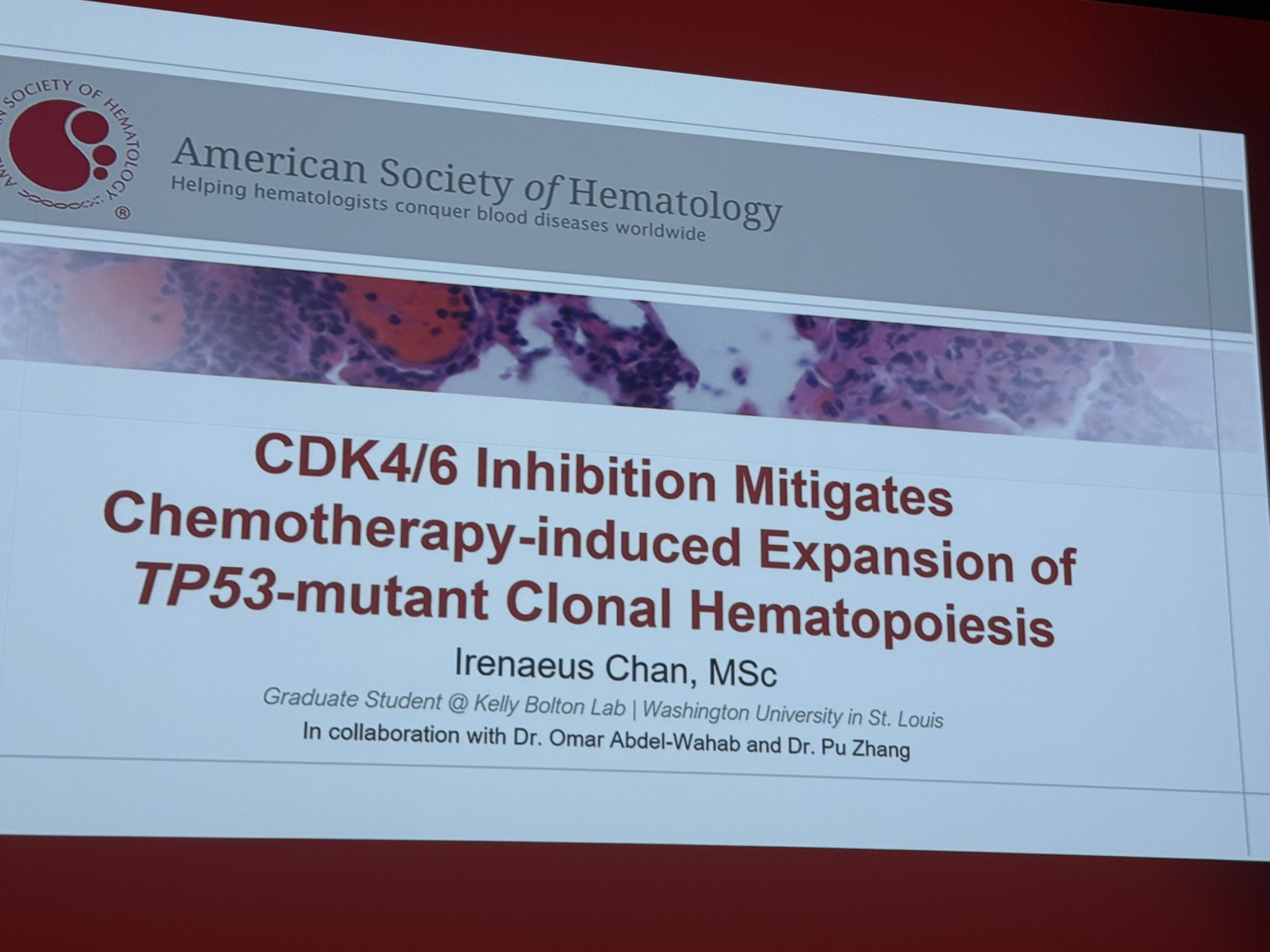 Joshua Zeidner: Plenary Talk on CDK4/6 Inhibition and TP53-Mutant Clones at ASH25 2 Joshua Zeidner: Plenary Talk on CDK4/6 Inhibition and TP53-Mutant Clones at ASH25