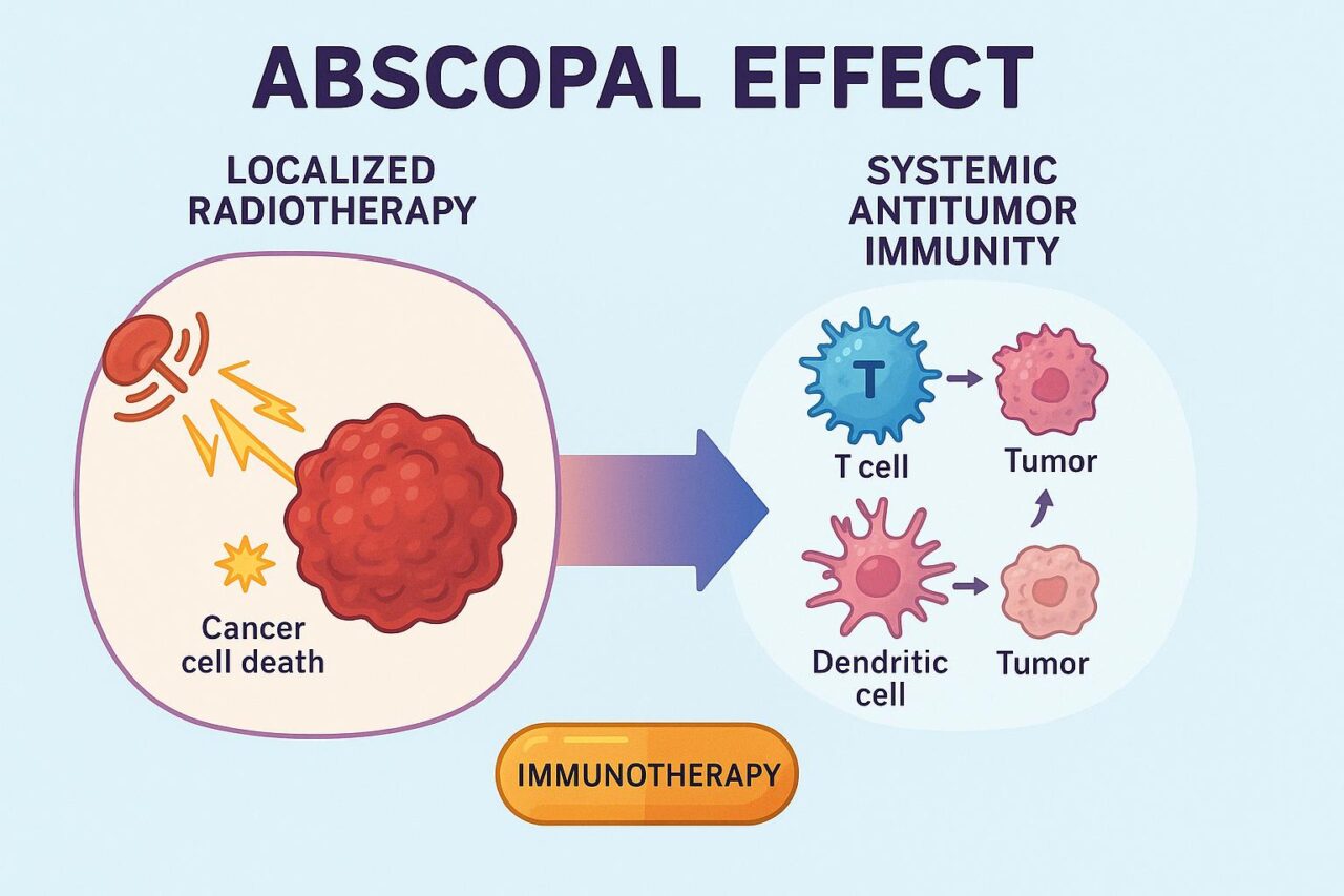 Radiotherapy’s Abscopal Effect: Mechanisms, Challenges, and Key ...