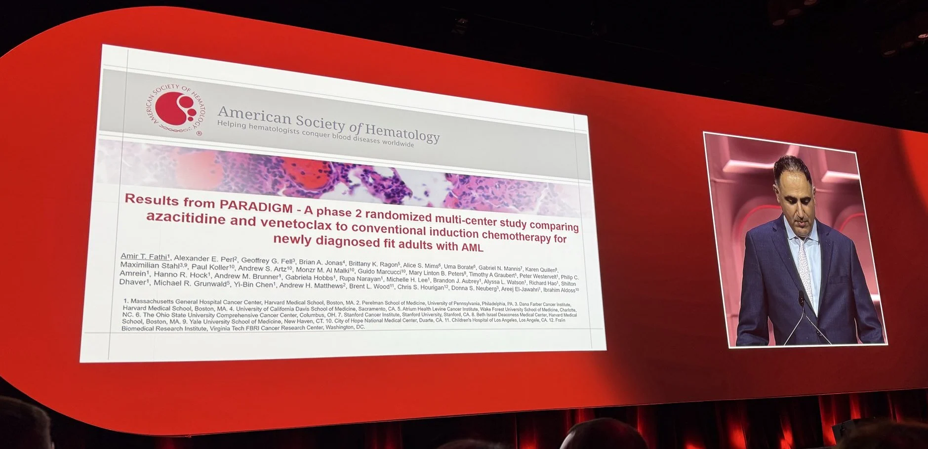 Uma Borate: Paradigm Study Highlights Aza-Ven Benefits in High-Risk AML 2 Uma Borate: Paradigm Study Highlights Aza-Ven Benefits in High-Risk AML