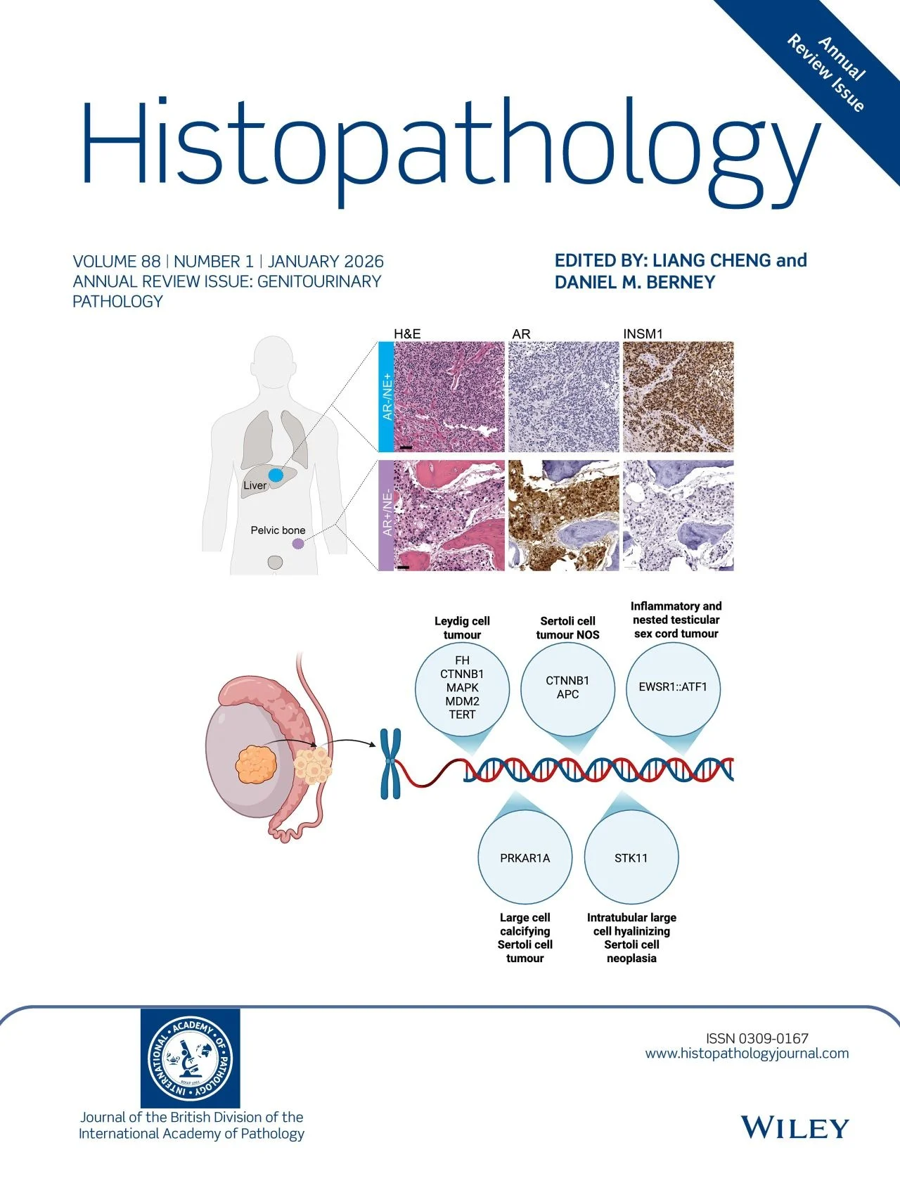 Liang Cheng: Launch of 20th Anniversary Annual Review Issue of Histopathology