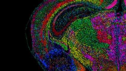 Gianrico Farrugia: AI Can Transform Healthcare - If We Transform our Data Architecture