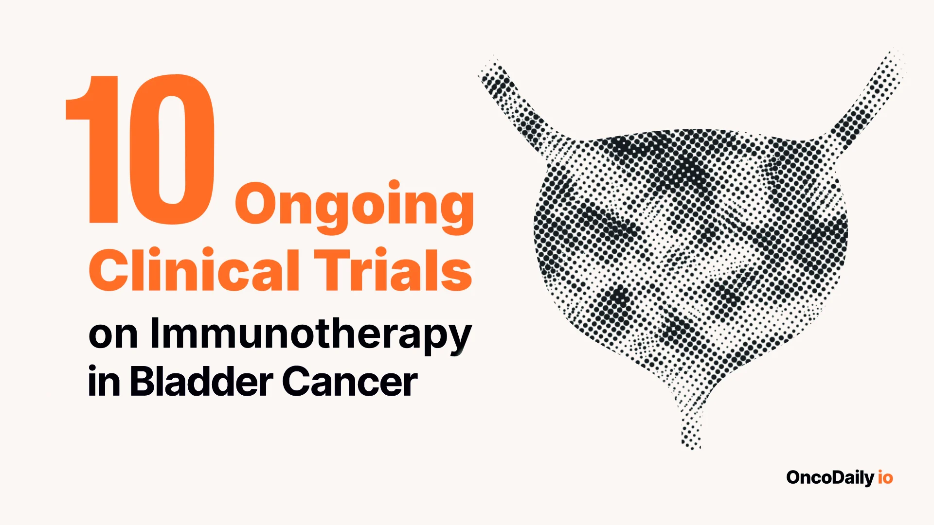 10 Ongoing Clinical Trials on Immunotherapy in Bladder Cancer