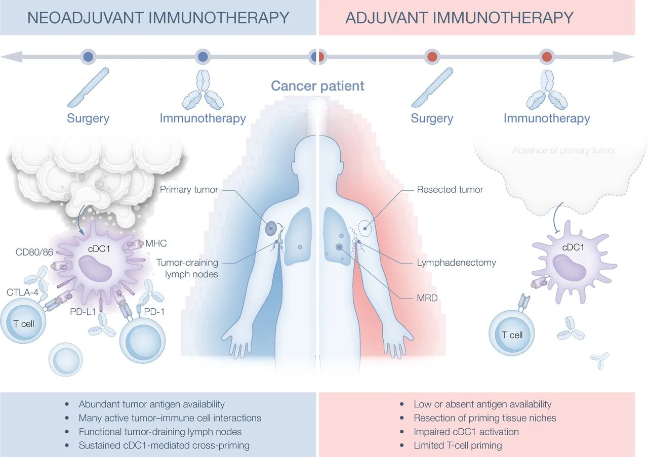 Immunotherapy in Minimal Residual Disease in Melanoma: Why Checkpoint Blockade Alone Is Not Enough 2 melanoma