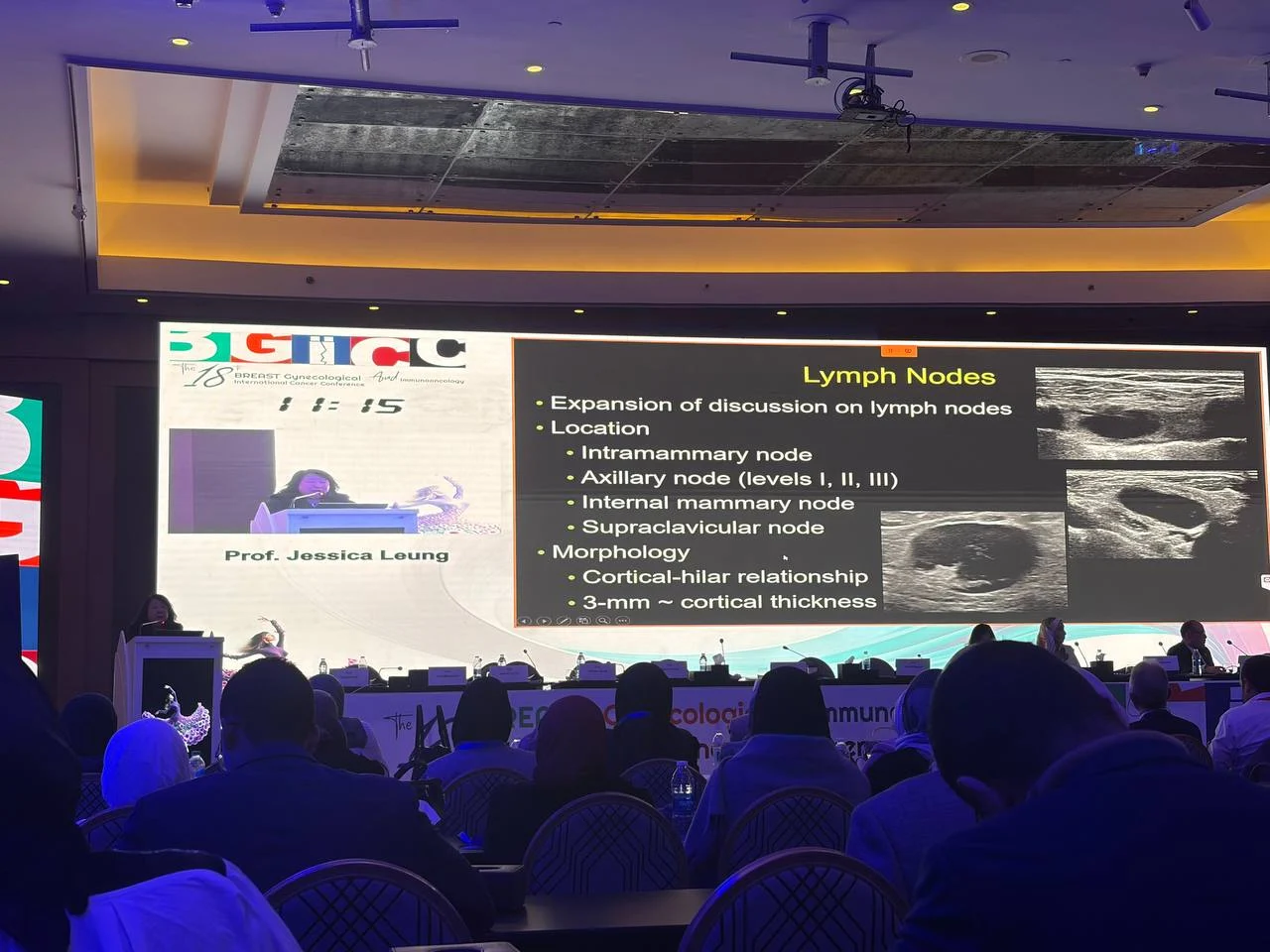 Highlights from BGICC 2026: What’s New in BI-RADS 2025 Nodal Imaging — Insights from Prof. Jessica Leung 4 BI-RADS 2025