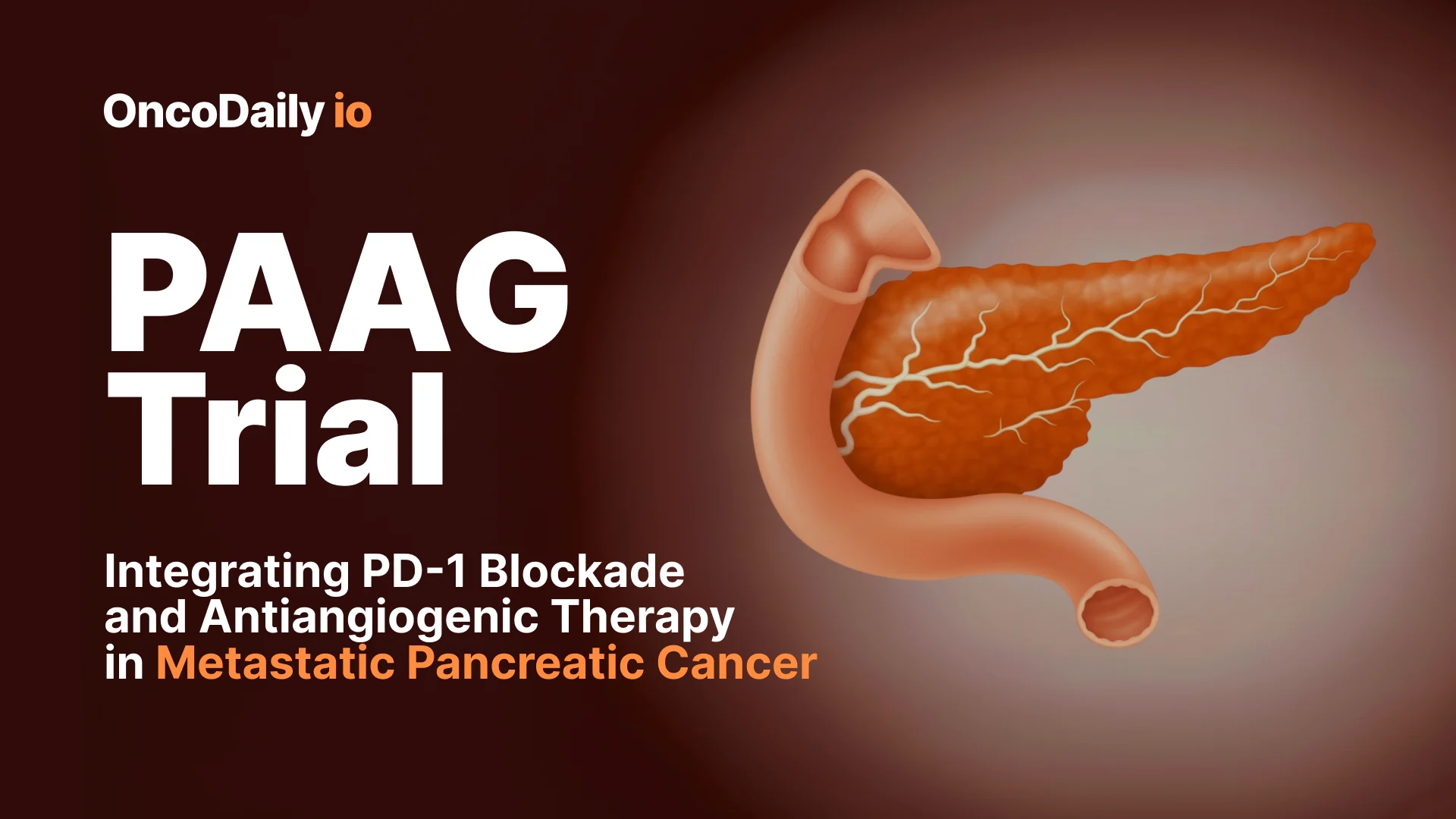 PAAG Trial: Integrating PD-1 Blockade and Antiangiogenic Therapy in Metastatic Pancreatic Cancer