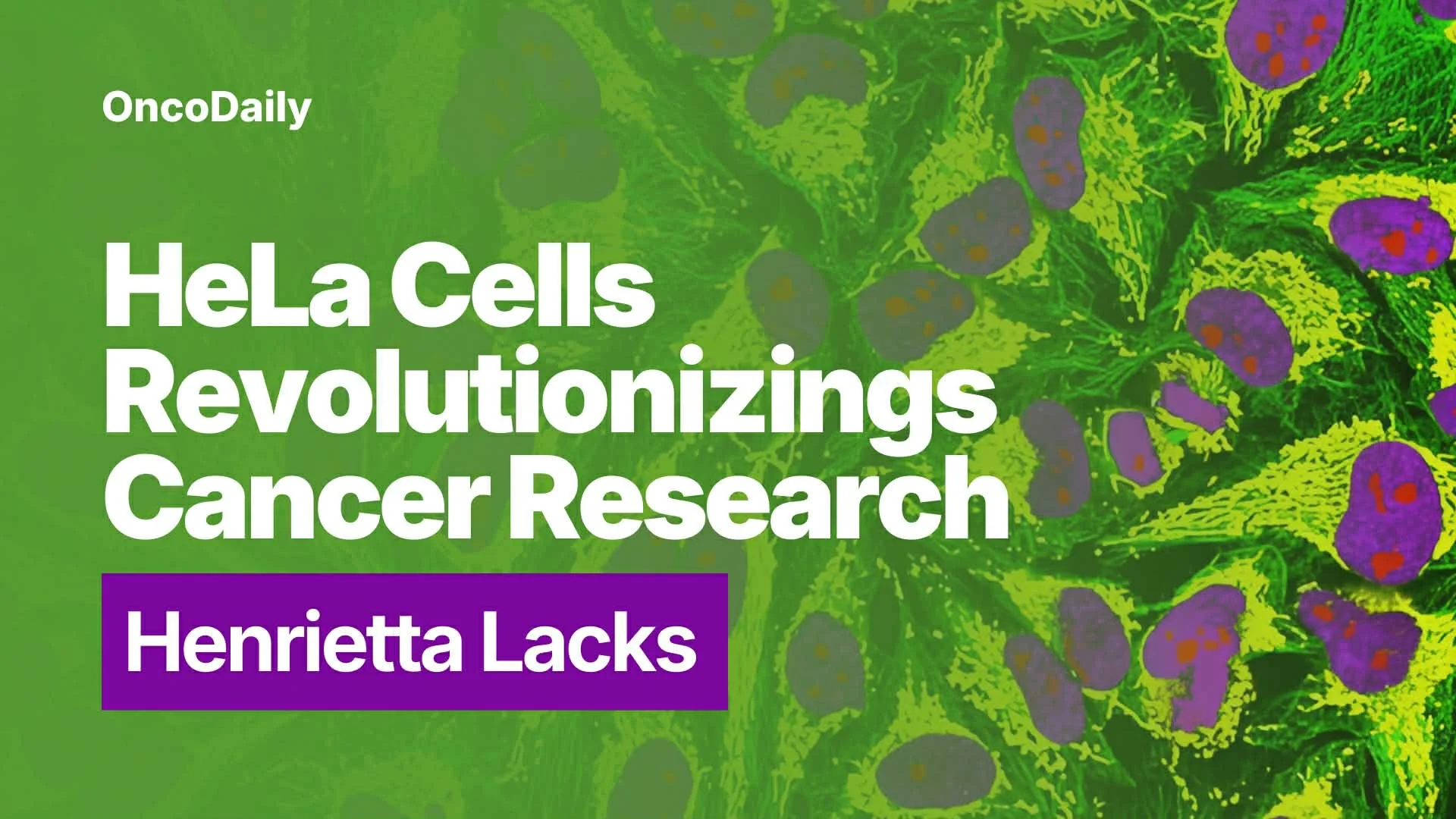 HeLa Cells and Henrietta Lacks