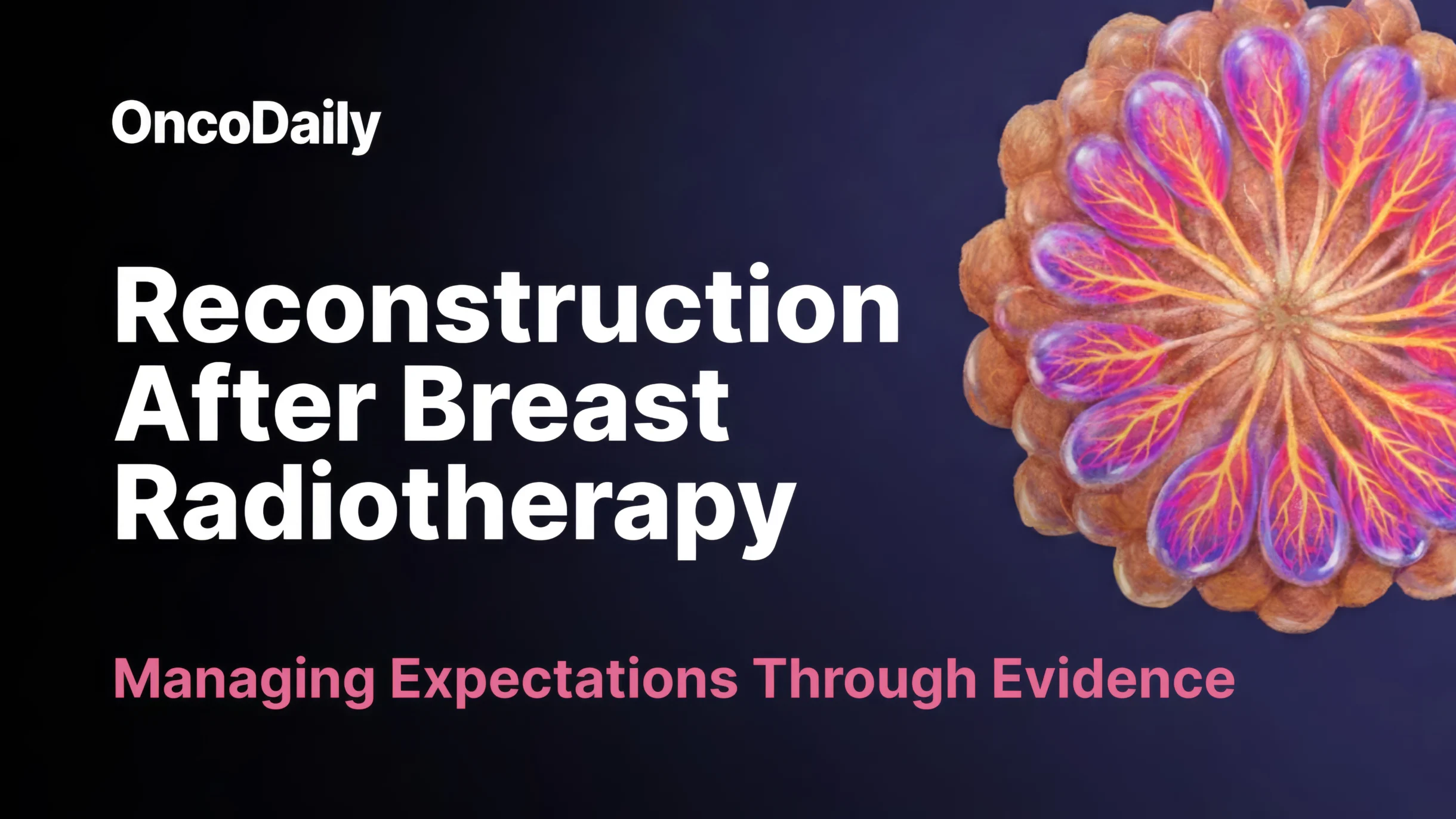 breast radiotherapy