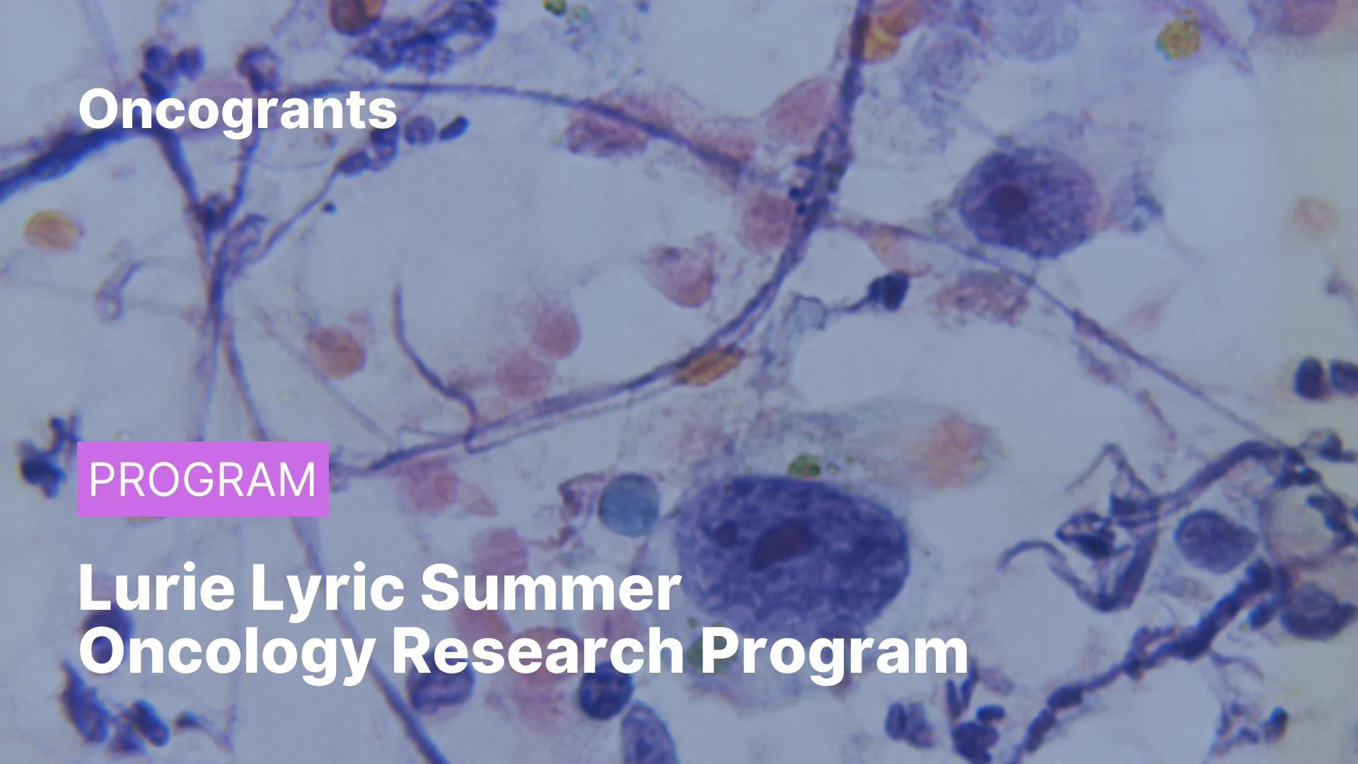 Lurie Lyric Summer Oncology Research Program 2026