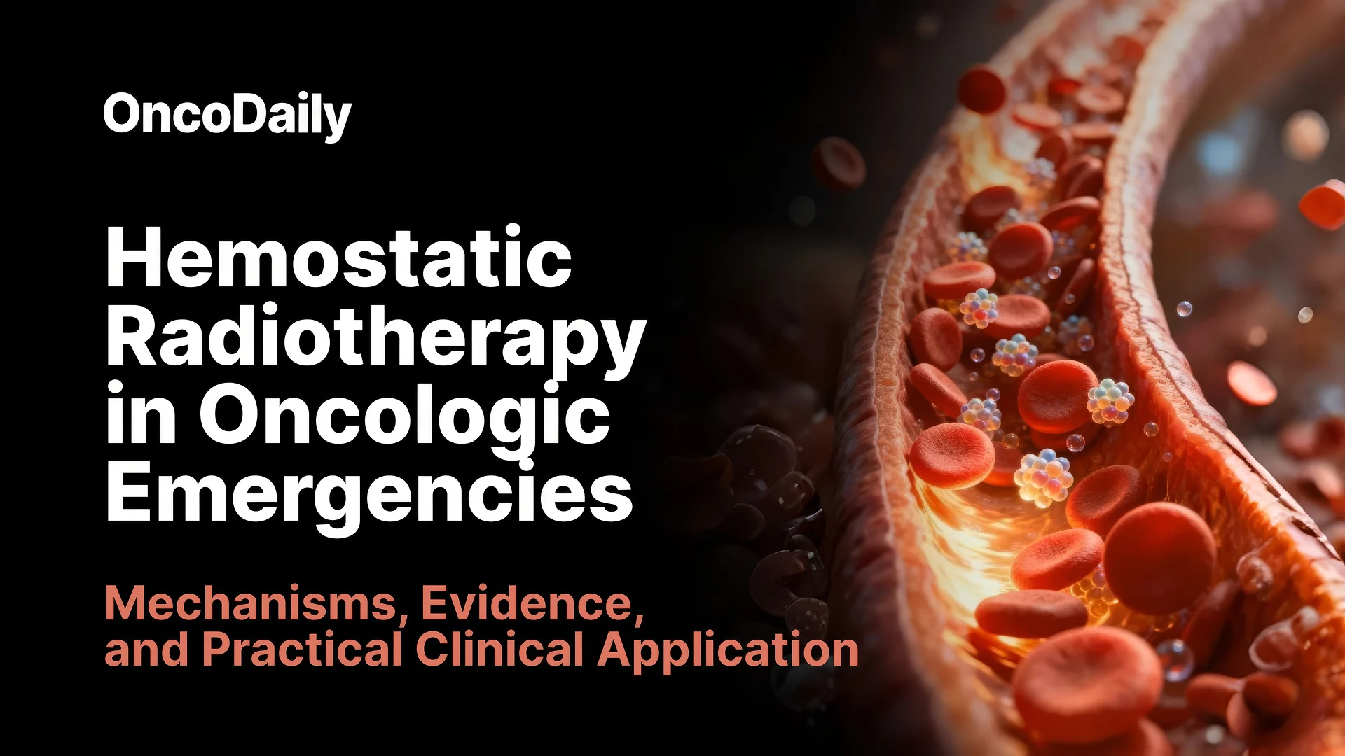Hemostatic Radiotherapy