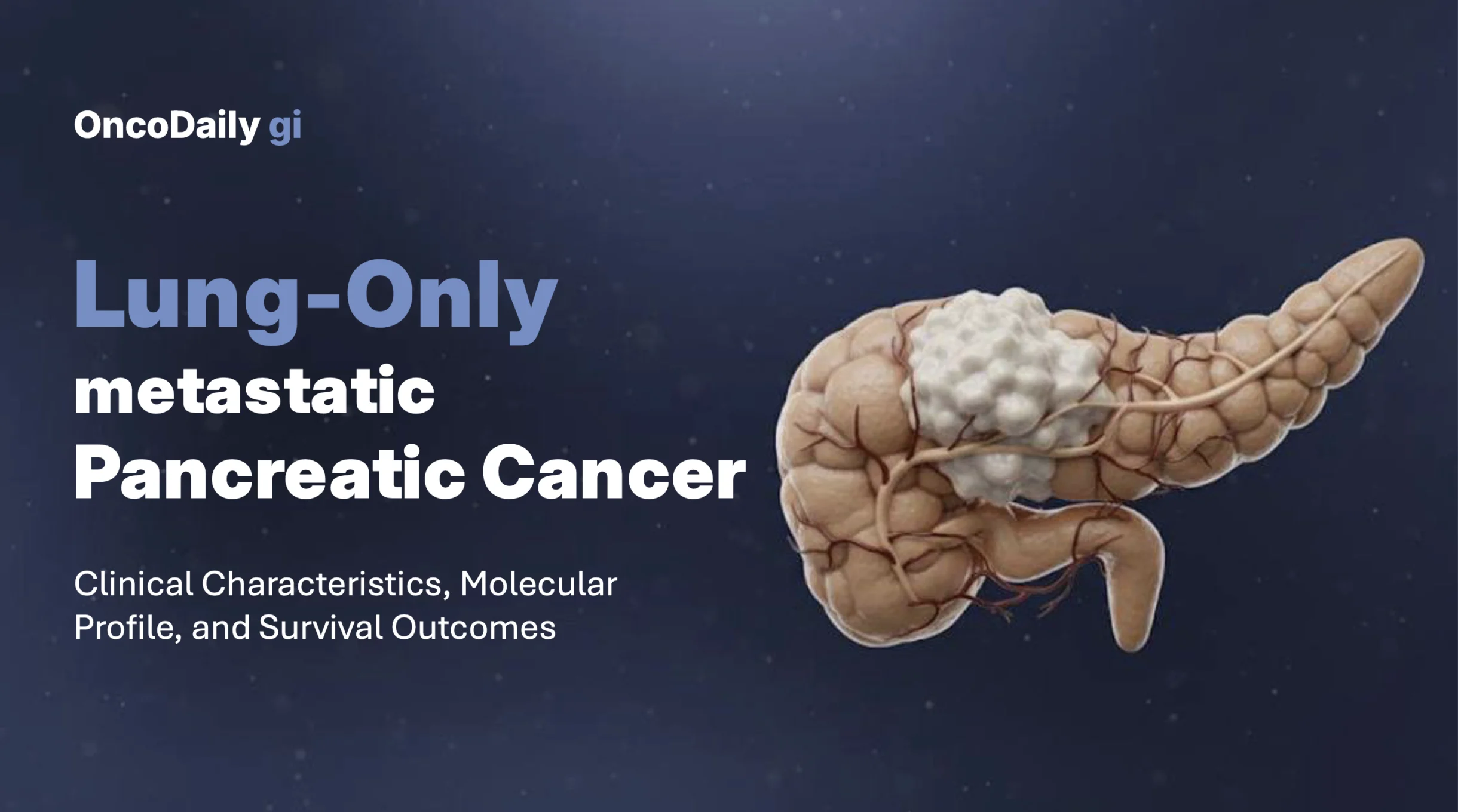 Pancreatic ductal adenocarcinoma