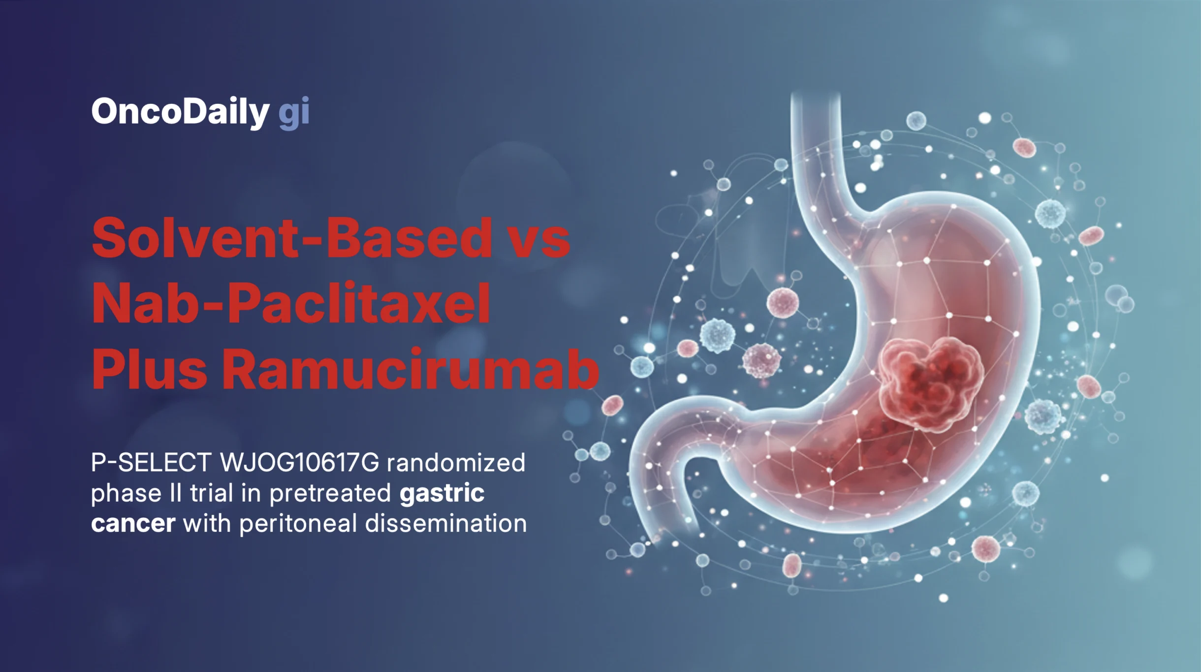 gastric cancer