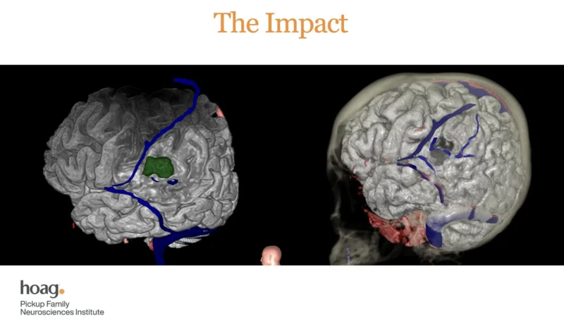 Robert Louis: The Field Needs the Discipline to measure What Matters Without the Confusion