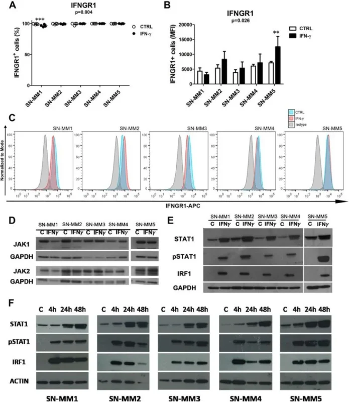 Integrating New Immune Predictors for Mucosal Melanoma Immunotherapeutic Strategies- JITC