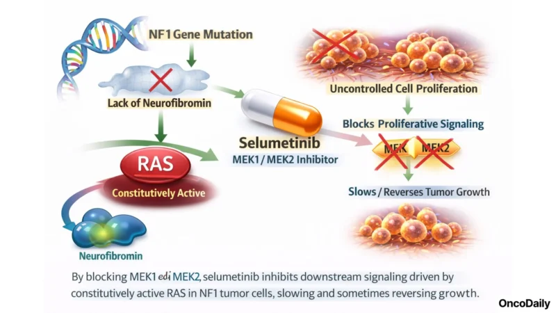 Health Canada Approves Selumetinib (Koselugo) for Adult NF1 Plexiform Neurofibromas 3 KOMET Phase 3
