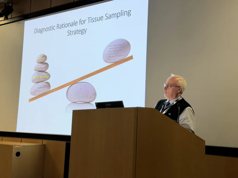 Cecilia Pompili: Multidisciplinary Care is the Future of Lung Cancer Education 2 Cecilia Pompili