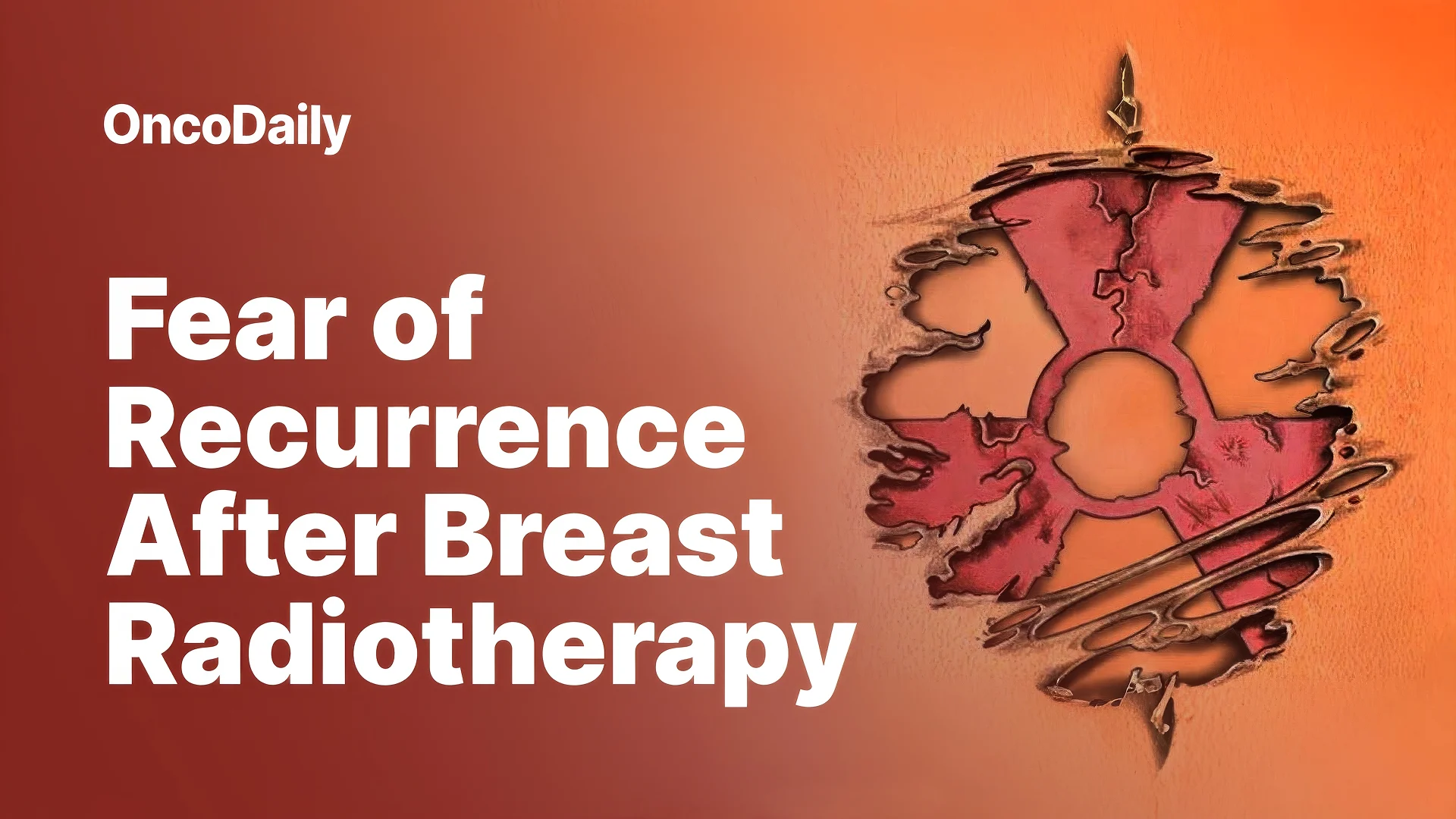 Breast Radiotherapy