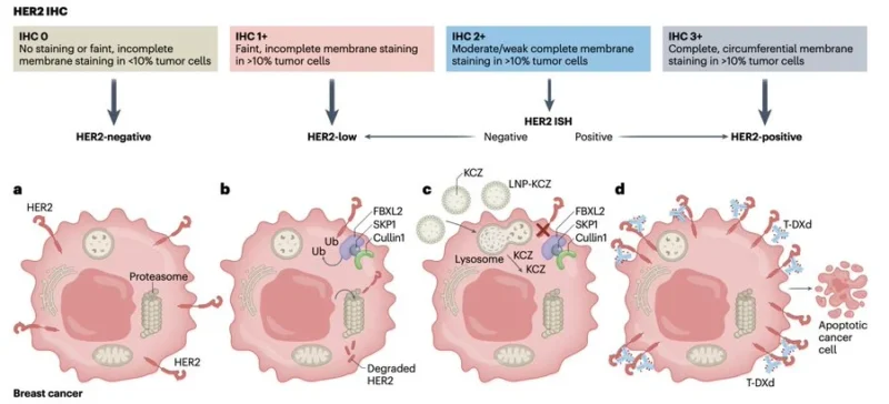 Sergio Cifuentes-Canaval: Preventing HER2 Degradation Enhances Trastuzumab Deruxtecan Efficacy