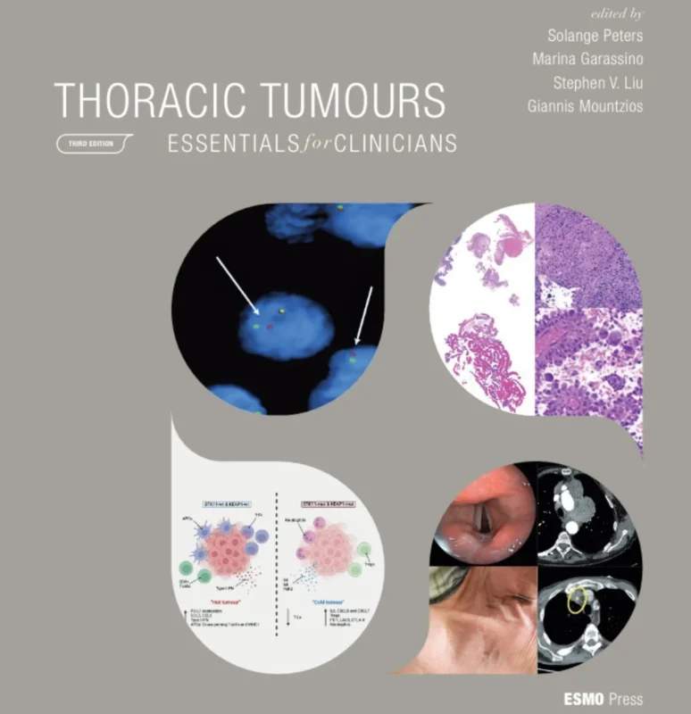 Giannis Mountzios: New ESMO Thoracic Essentials For Clinicians Handbook Launched Online