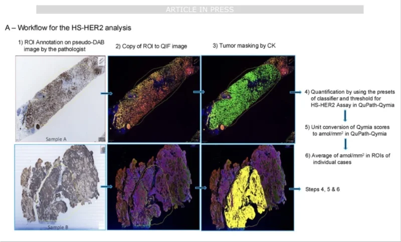Trastuzumab Deruxtecan