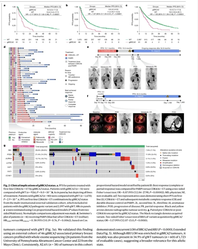 BRCA2-Driven Breast Cancer May Follow A Different Resistance Path On CDK4/6 Inhibitors 4 BRCA2-Driven Breast Cancer