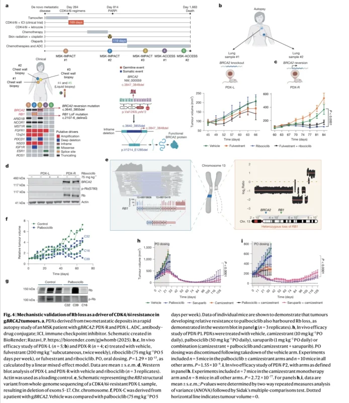 BRCA2-Driven Breast Cancer May Follow A Different Resistance Path On CDK4/6 Inhibitors 6 BRCA2-Driven Breast Cancer May Follow A Different Resistance Path On CDK4/6 Inhibitors