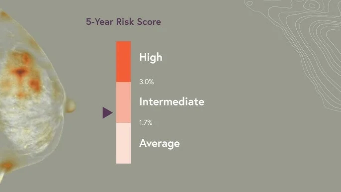 How The Clairity Model Could Change Breast Cancer Risk Prediction 4 Clairity Model