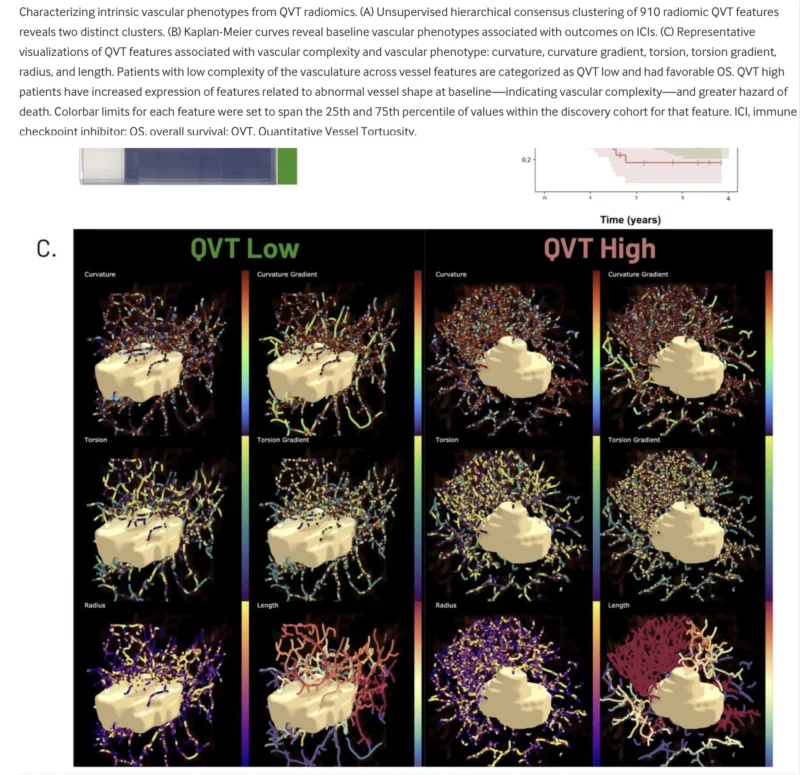 QVT Score In NSCLC Immunotherapy