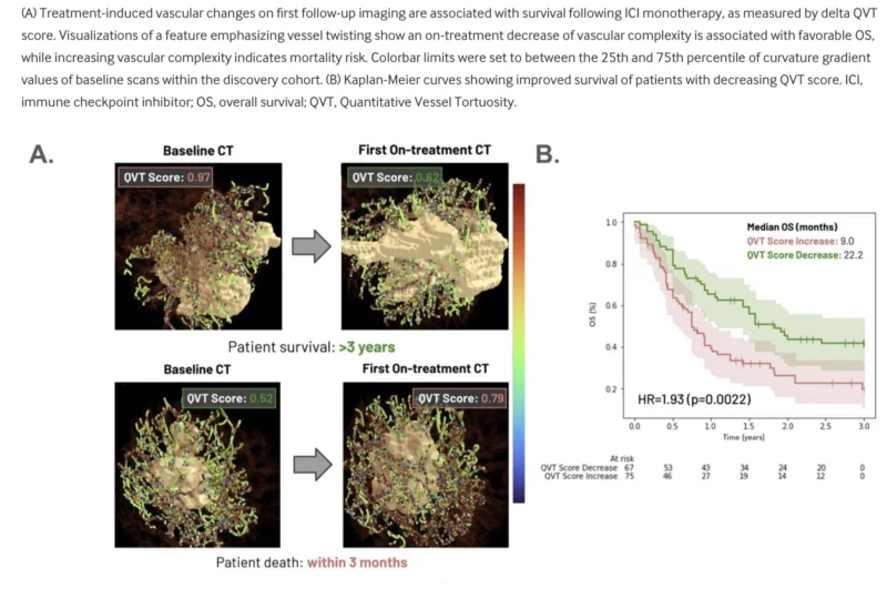 QVT Score In NSCLC Immunotherapy