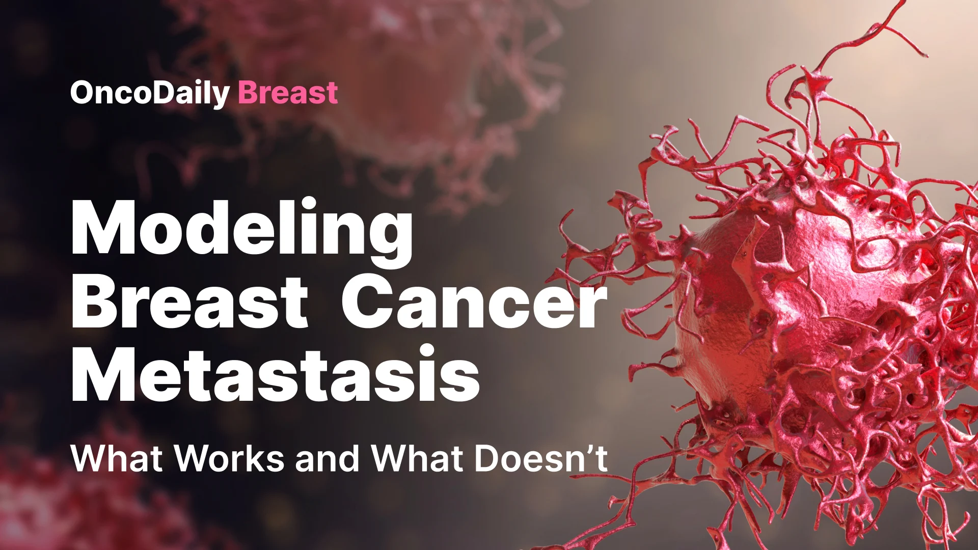 Breast Cancer Metastasis