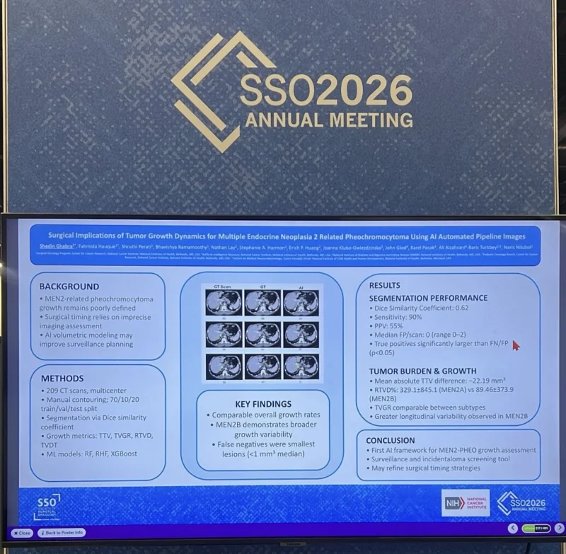 Shadin Ghabra: Excited to Present AI-based Imaging in MEN2 Related Pheochromocytoma at SSO26