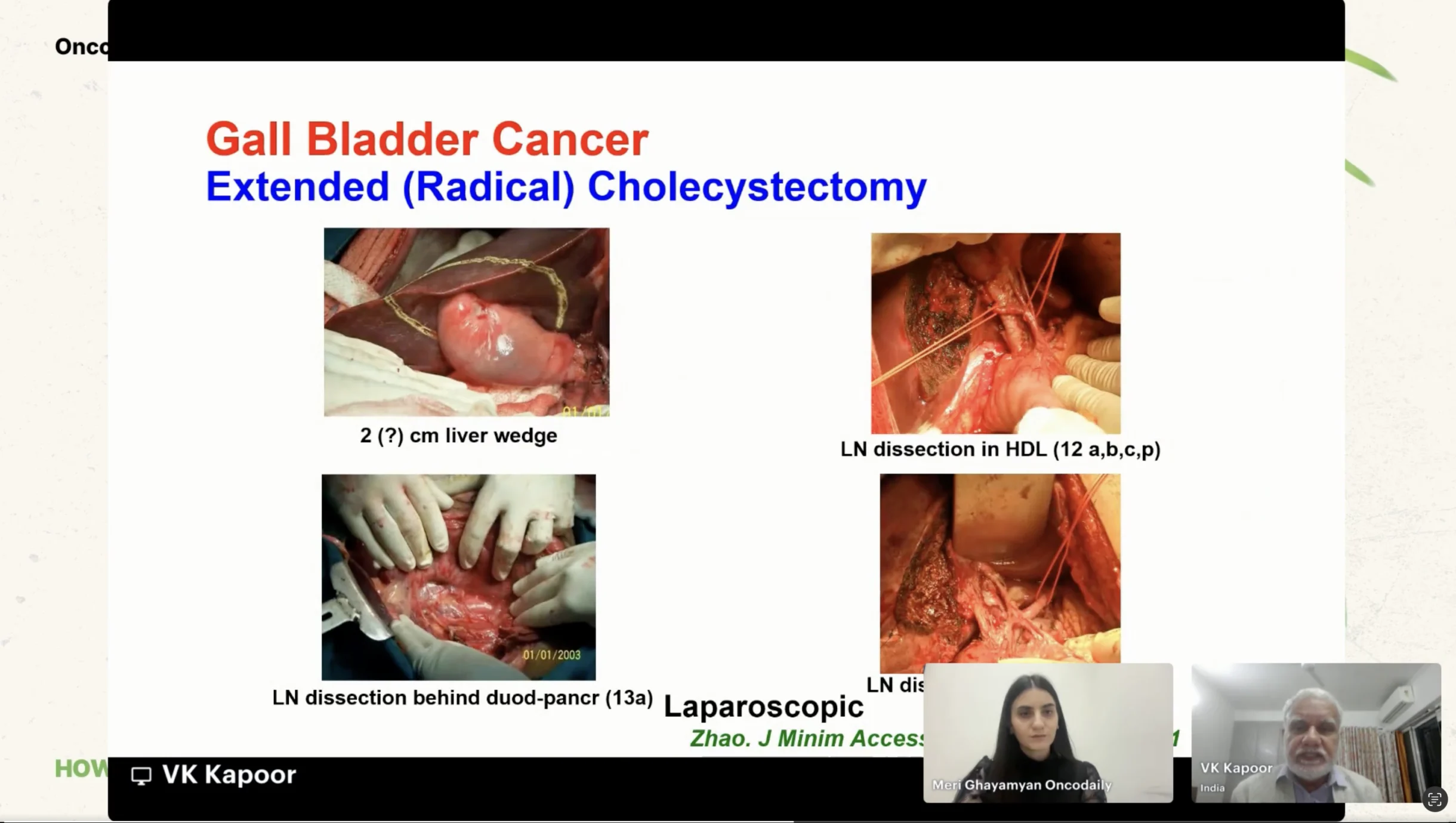 How I Treat Gallbladder and Bile Duct Cancer in 2026
