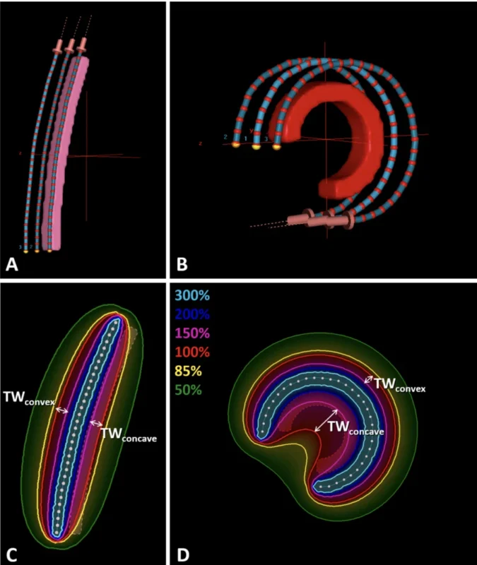 Nautilus Effect - OncoDaily