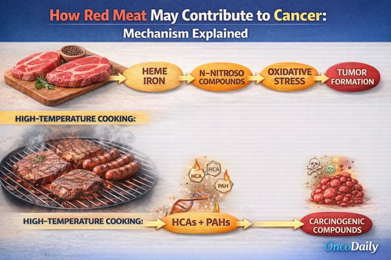 Does Red Meat Cause Cancer?