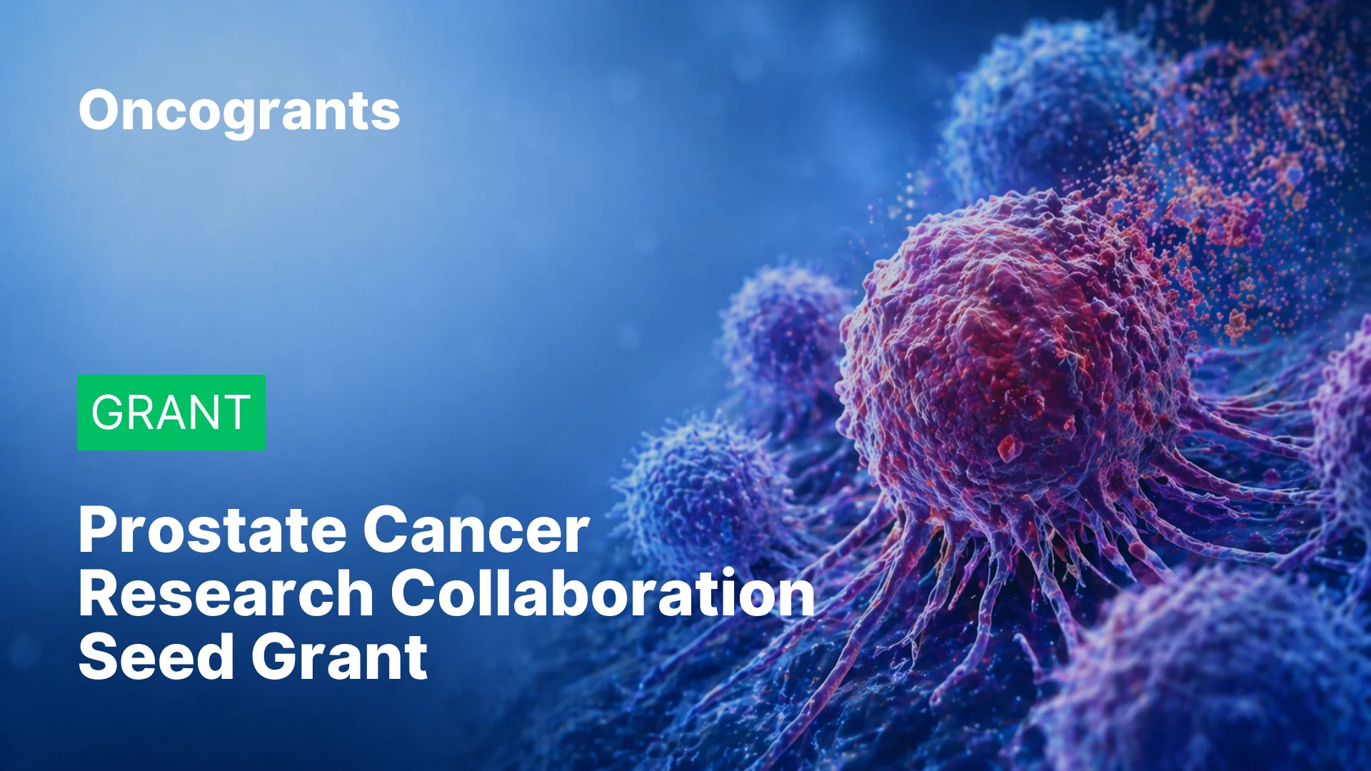 Prostate Cancer Research (UK Charity) Patient and Public Involvement (PPI) Seed Grant