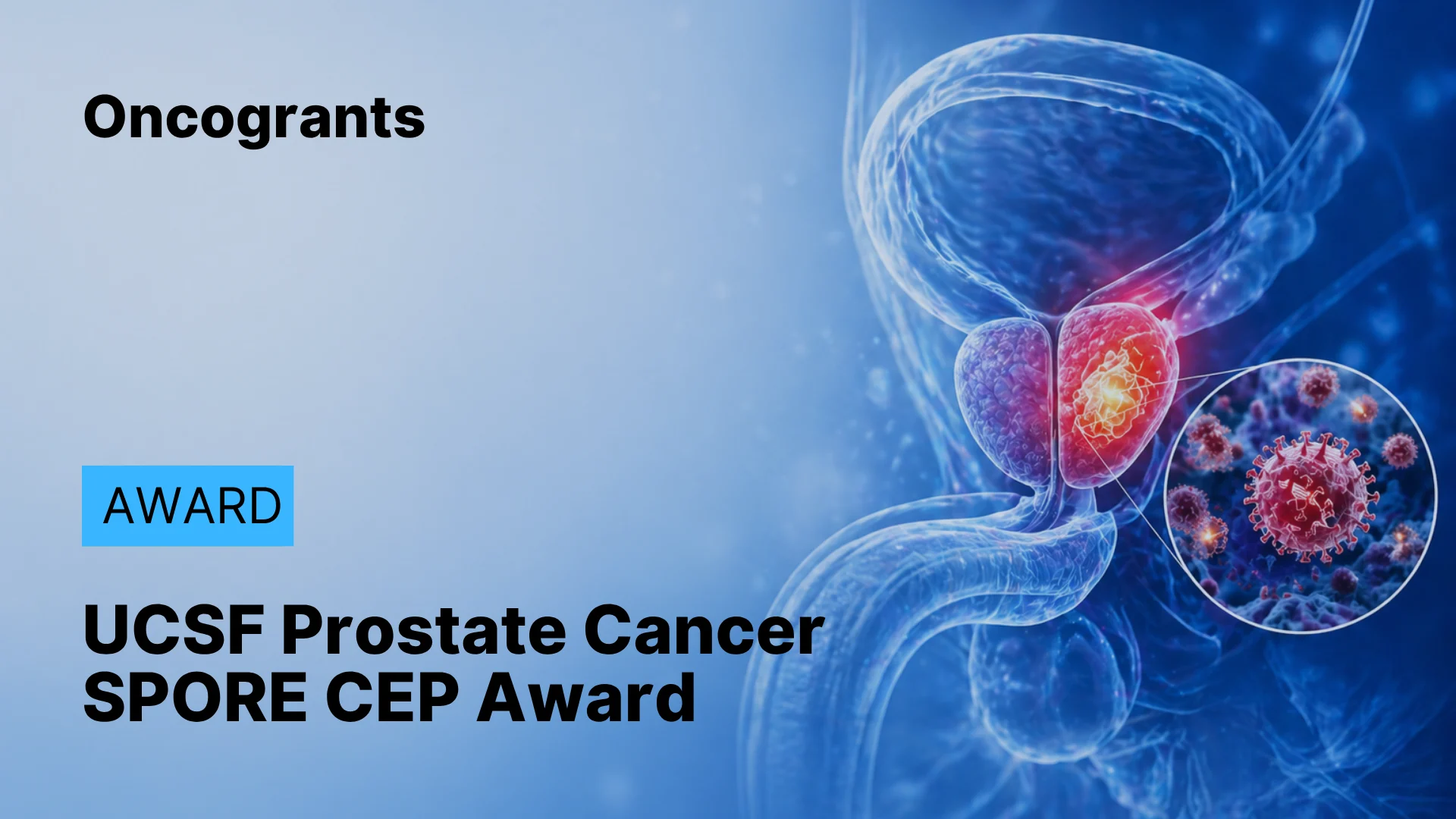 UCSF Prostate Cancer SPORE 2026 Career Enhancement Program (CEP) Award