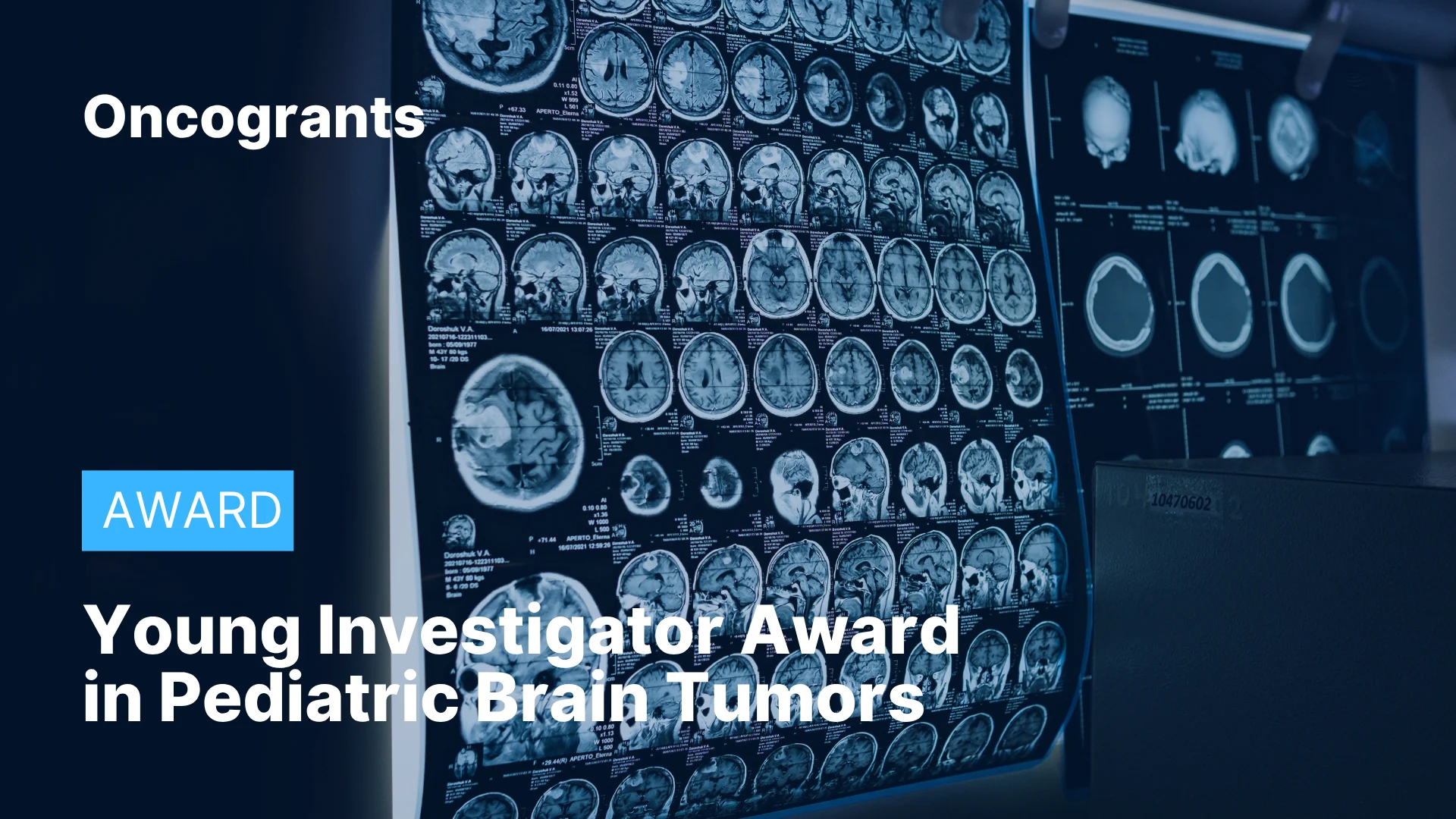 Young Investigator Award in Pediatric Brain Tumors