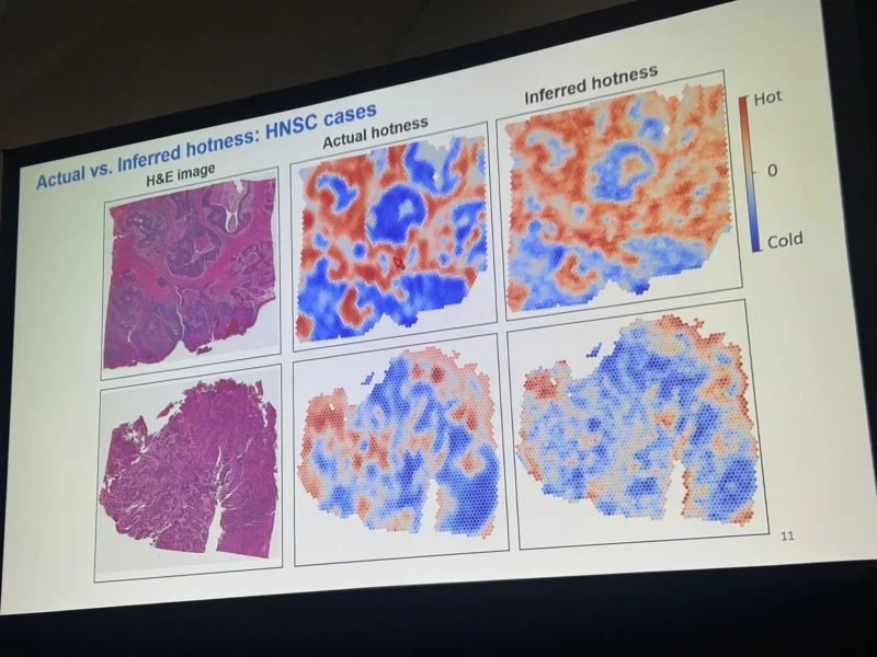 Sanam Loghavi: The Enduring Power of H and E in the Genomics and AI Era