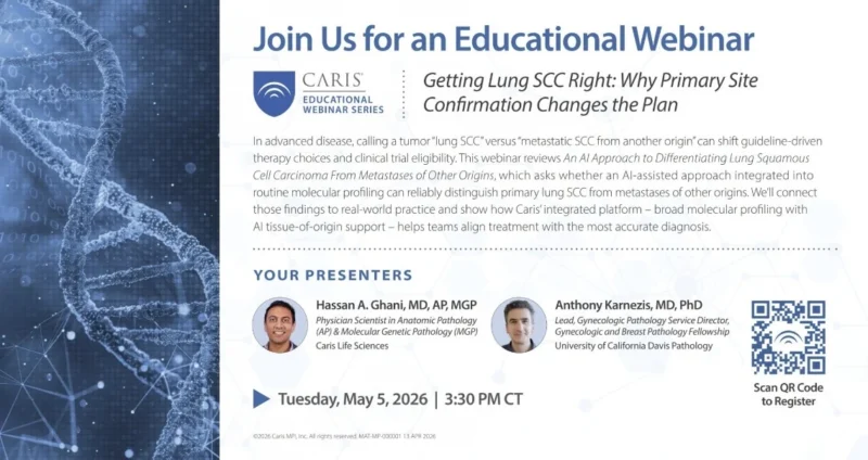 Matthew Oberley: Upcoming Webinar on AI in Diagnosis of Lung SCC