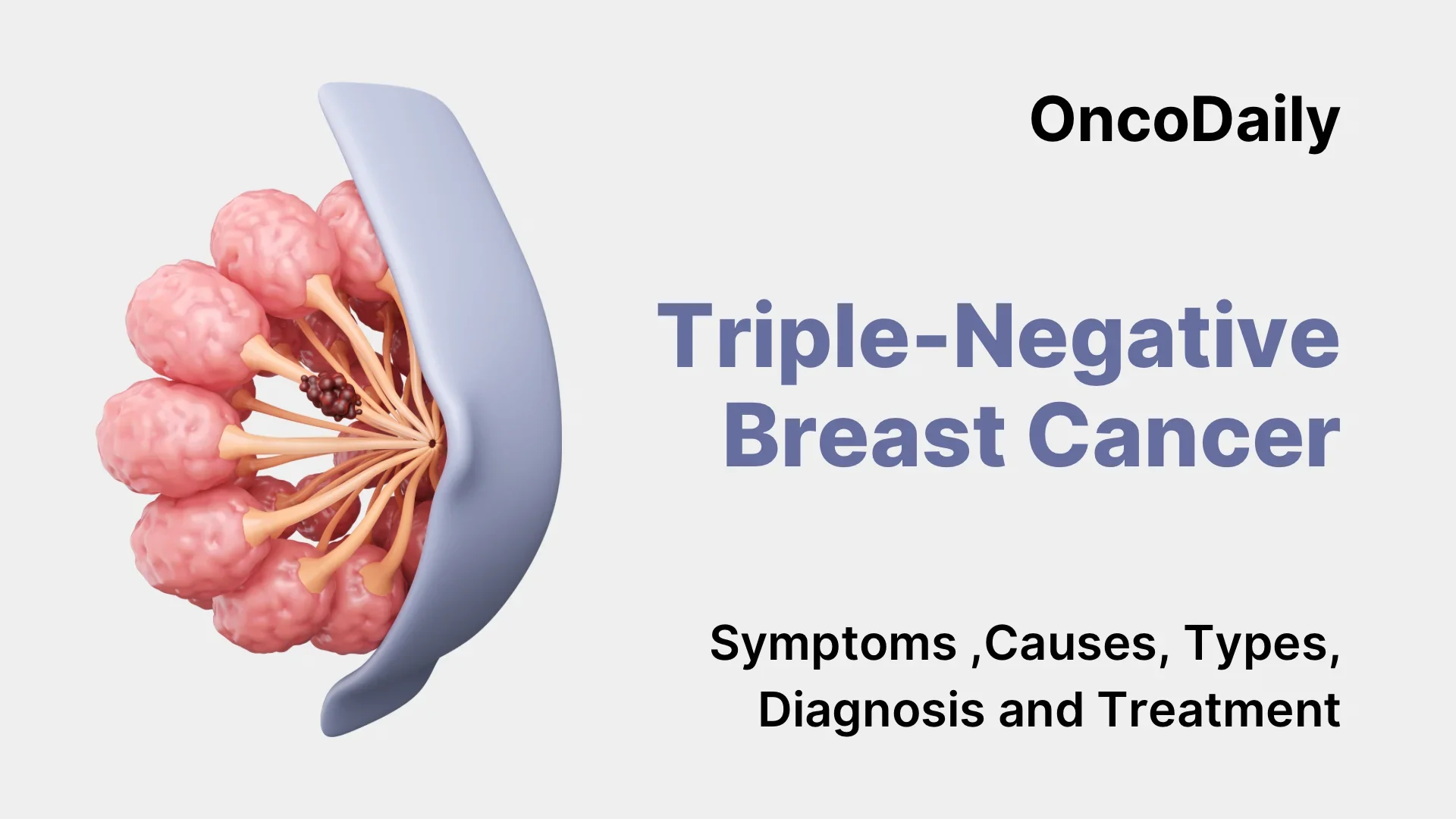 Triple Negative Breast Cancer