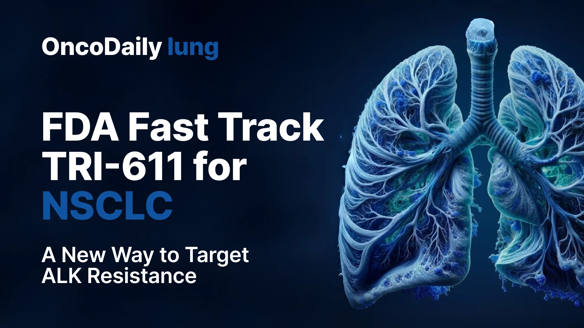 FDA Grants Fast Track Designation to TRI-611 in ALK-Positive NSCLC
