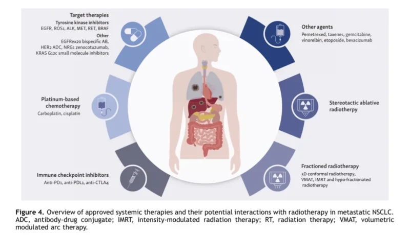 Definitive Radiotherapy to the Primary Tumor in Stage IV NSCLC: What the New IASLC Consensus Means 5 Definitive Radiotherapy