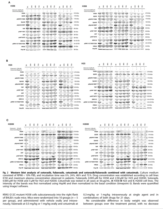 KRAS G12C NSCLC