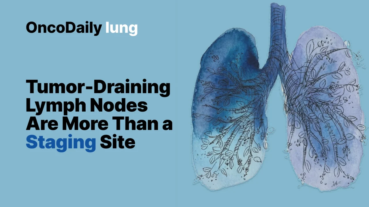 Tumor-Draining Lymph Nodes in NSCLC: The Underused Frontier in Biomarker Discovery and Therapeutic Innovation