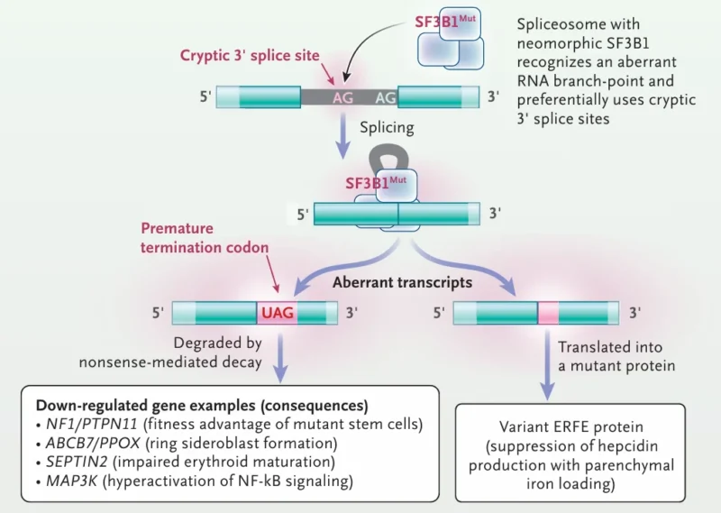 Myelodysplastic Neoplasms (MDS): From Ineffective Hematopoiesis to Sideroblastic Phenotype