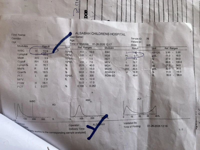 leukemia - OncoDaily