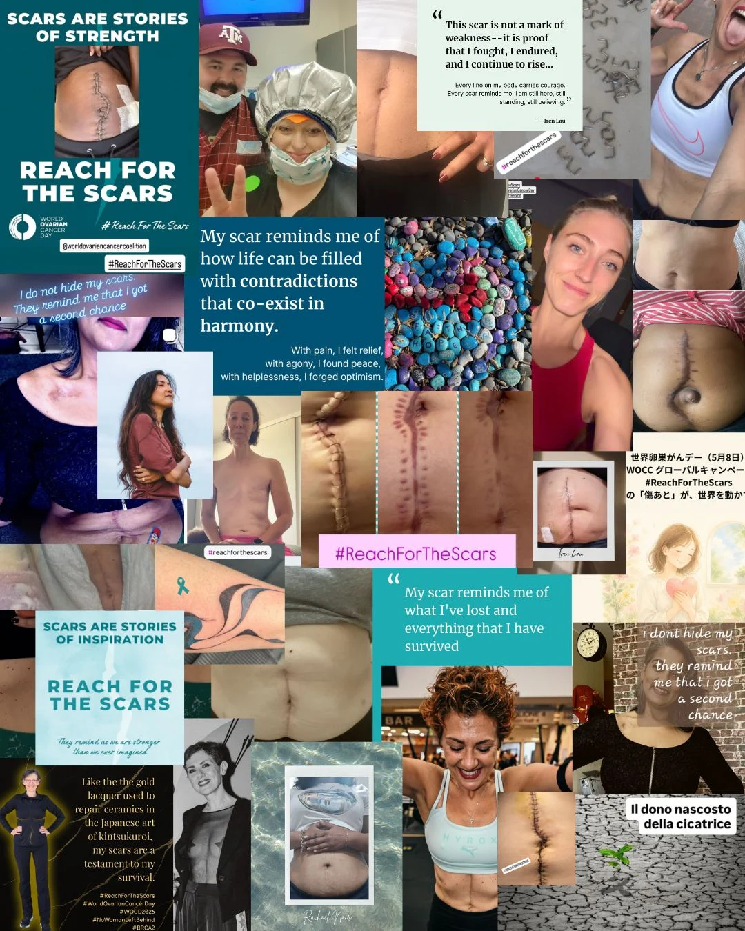 What Ovarian Cancer Looks Like - World Ovarian Cancer Coalition