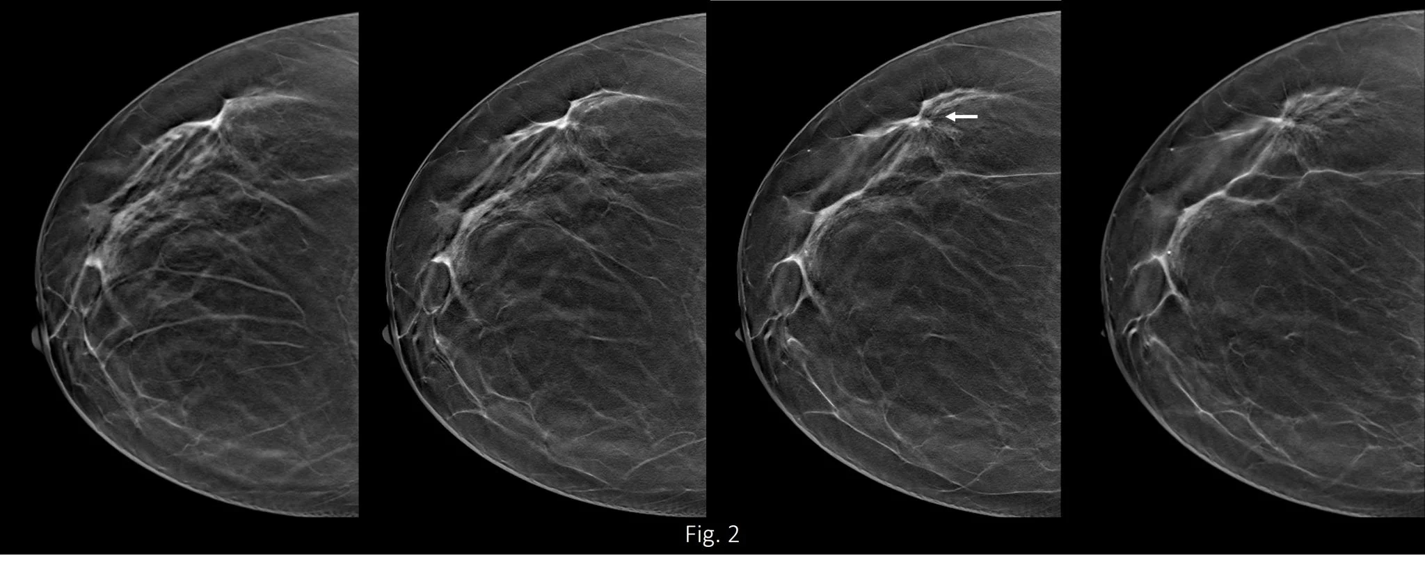 Sahar Mansour: Early Detection Isn’t Just About Finding Abnormalities - It’s About Understanding Them Correctly