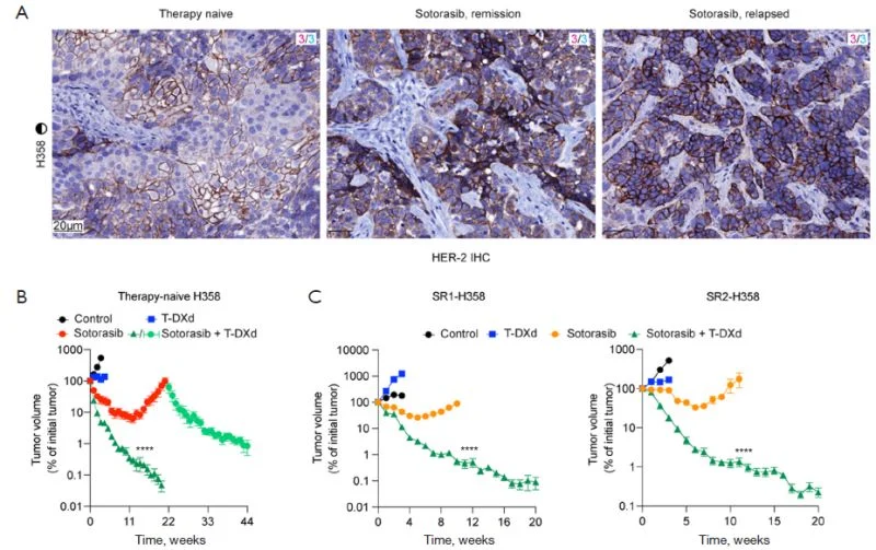 Bruna Pellini: Our New Manuscript Explores Sotorasib Plus T-DXd in KRAS G12C-Mutant NSCLC